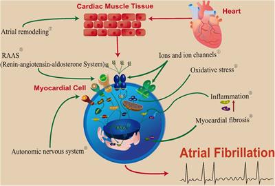 The application and mechanism of Chinese medicine in the upstream treatment of atrial fibrillation